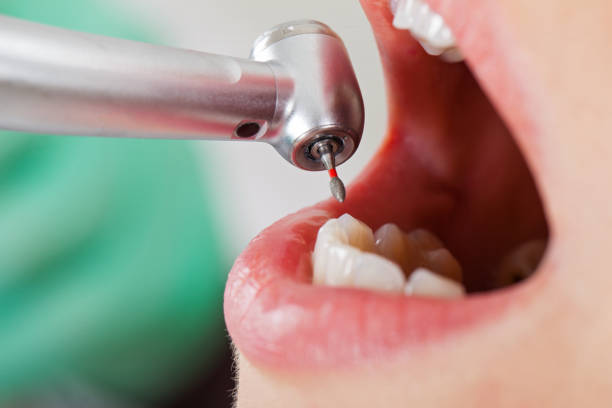 Best Emergency Dental Care for Trauma or Injury in Chula Vista, CA